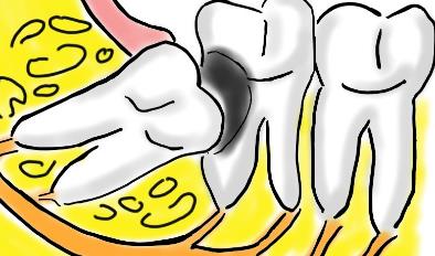 【上海浦东】半口即刻种植牙价格惊喜，只需5万起
