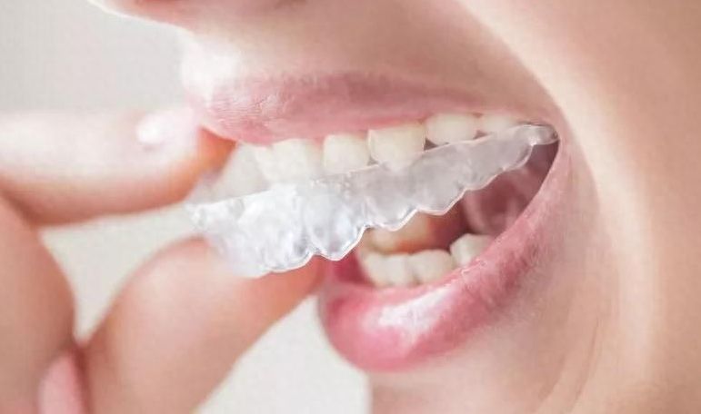昆华医院优质牙齿矫正价格公布，呵护口腔健康求美者必看！
