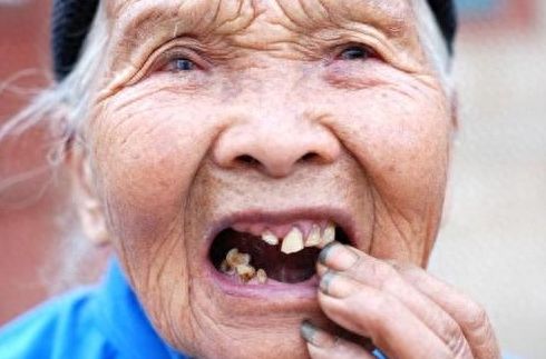 美奥种植牙的价格惊人低廉，免看诊费，真实可靠！
