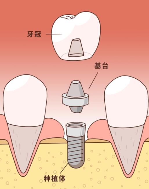 南昌维茂口腔价格查询及治疗费用介绍，稳定满足你的牙齿需求